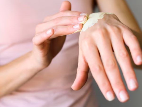 Pomada para queloide realmente suaviza cicatrizes antigas?