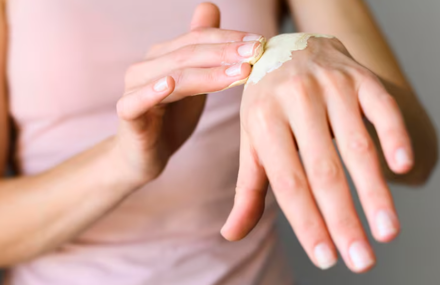 Pomada para queloide realmente suaviza cicatrizes antigas?